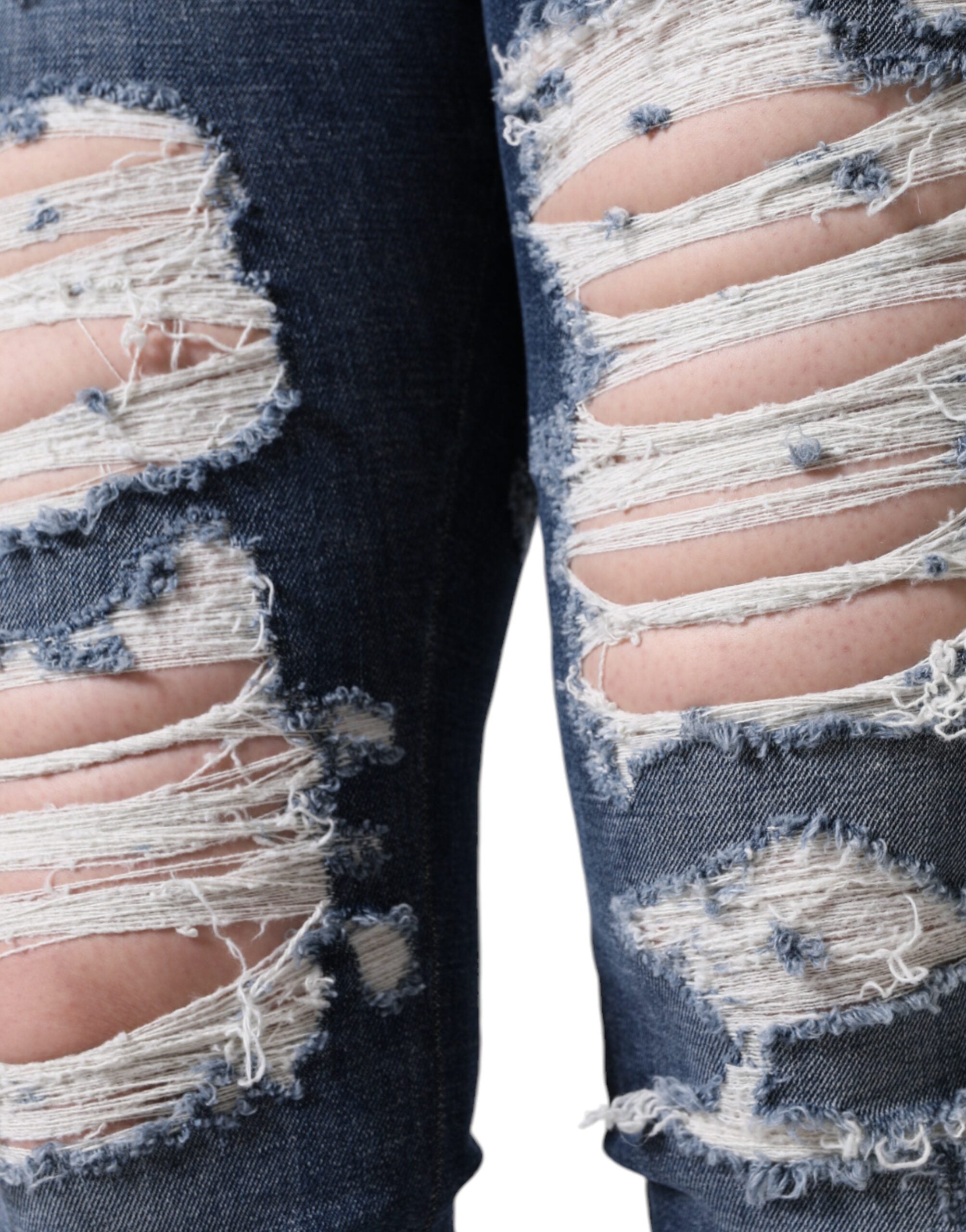Blue Cotton Stretch Tattered Skinny Jeans - ventzia